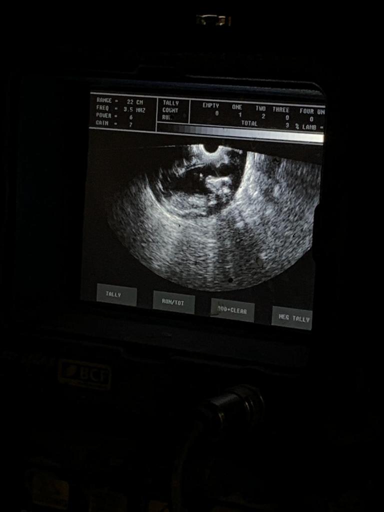 Fishers Farm ewe ultrasound scan image